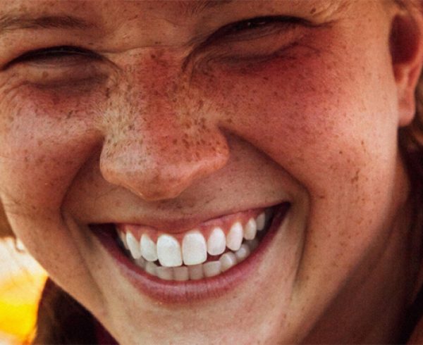 white-teeth